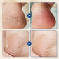 🎉Buy 2 Get 1 Free🎉Hydrating and Anti-Cracking Foot Cream