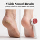 🦶 BUY 1 GET 1 FREE! 🏆 Double-Sided Foot Scraper for Callus – Stainless Steel, Dual Surface, Portable ✨