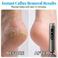 🥳2026 HOT SALE🥳💞50K+ SOLD!🏖️👍 50% OFF! 27,000 RPM Electric Foot Renewal – 5 speeds, disposable pads. No scrubbing, salon smooth at home. 🦶✨