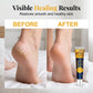 Moisturizing Anti-Crack Repair Foot Cream